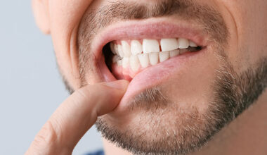 the small habits that can lead to big dental problems in kitchener