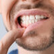 the small habits that can lead to big dental problems in kitchener