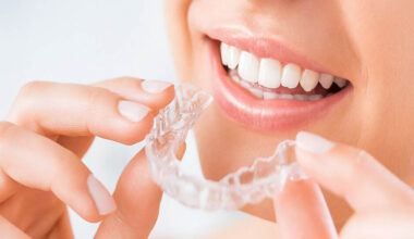 invisalign providers