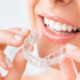invisalign providers