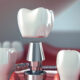 understanding tooth loss and solutions in st