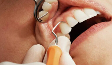 breakthrough innovations in gum health