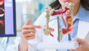exploring bariatric surgery and its benefits