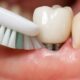 the daily to yearly dental implant care plan 1