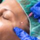 exploring advanced cosmetic procedures and facial rejuvenation